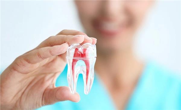 Root Canal Treatment